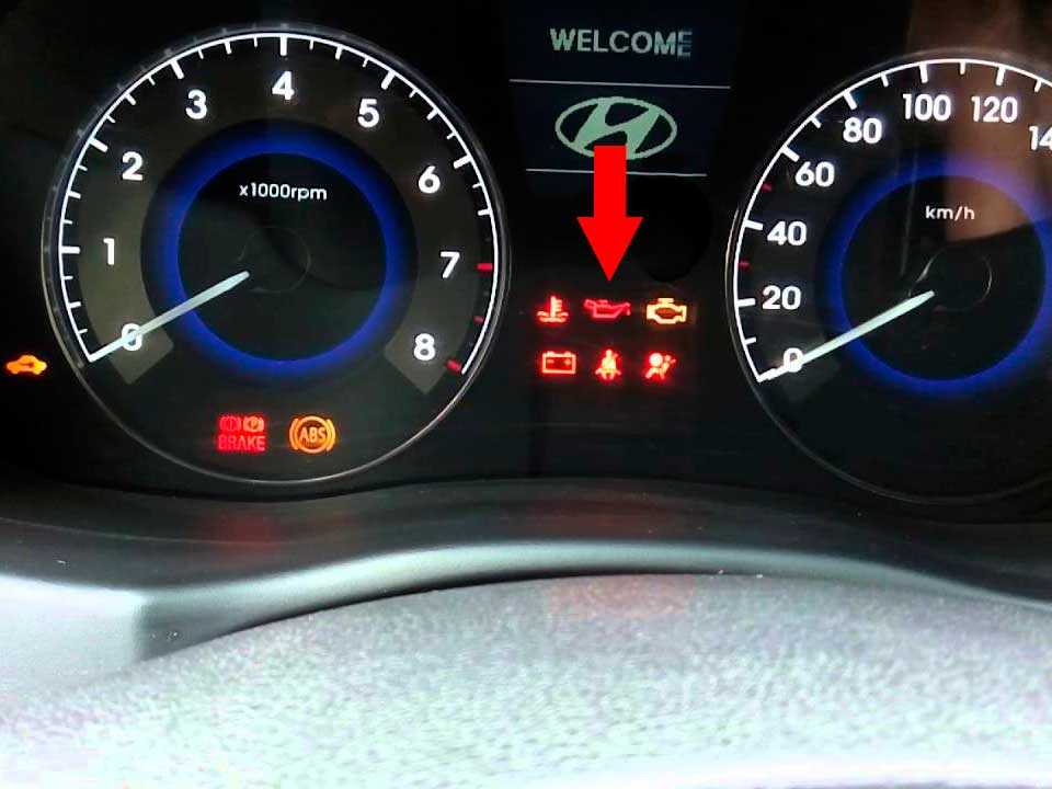 Загорелся чек двигателя — возможные причины